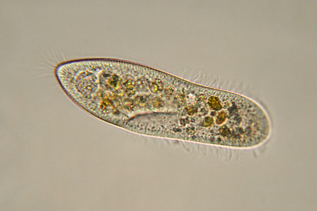 diversidad-y-clasificaci-n-del-reino-protista-un-vistazo-microsc-pico